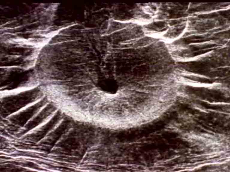 Венера. Вулканические кратеры, похожие на раздавленных насекомых.